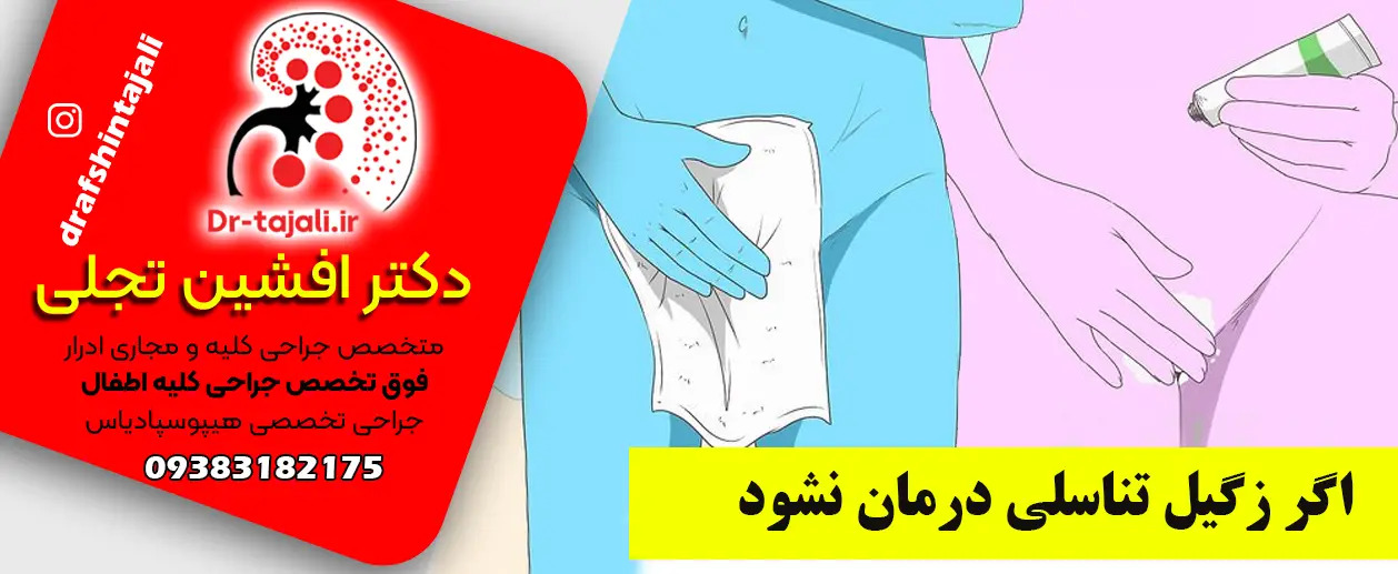 بهترین کلینیک لیزر زگیل تناسلی در اصفهان